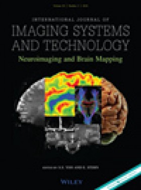 Journal Of Real-time Image Processing